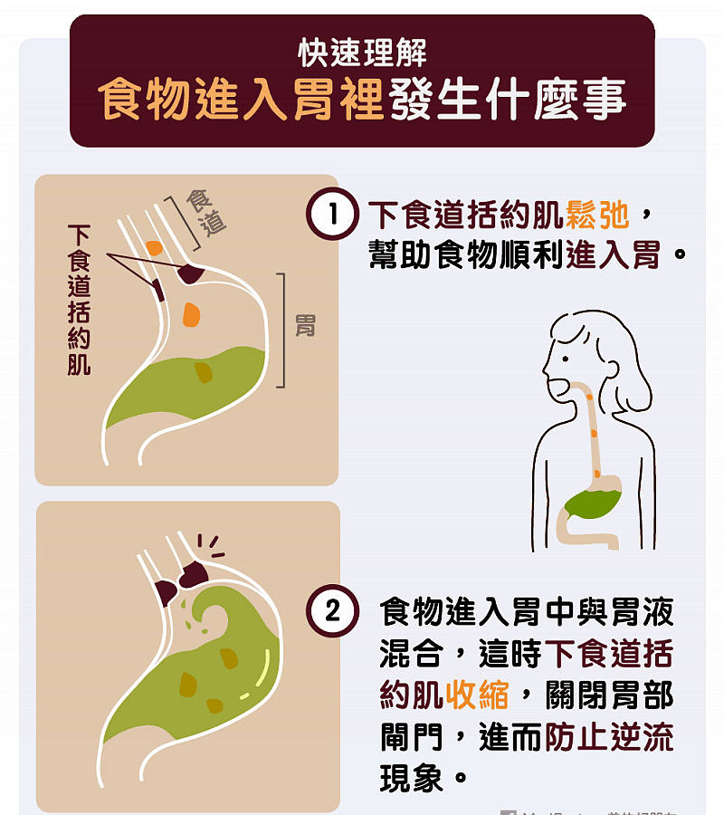 10個方法預防胃食道逆流 