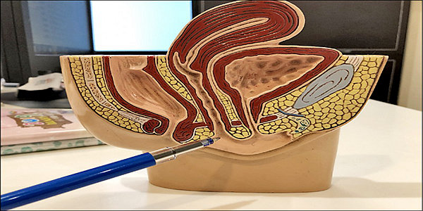 了解女性陰道結構,不當早洩男